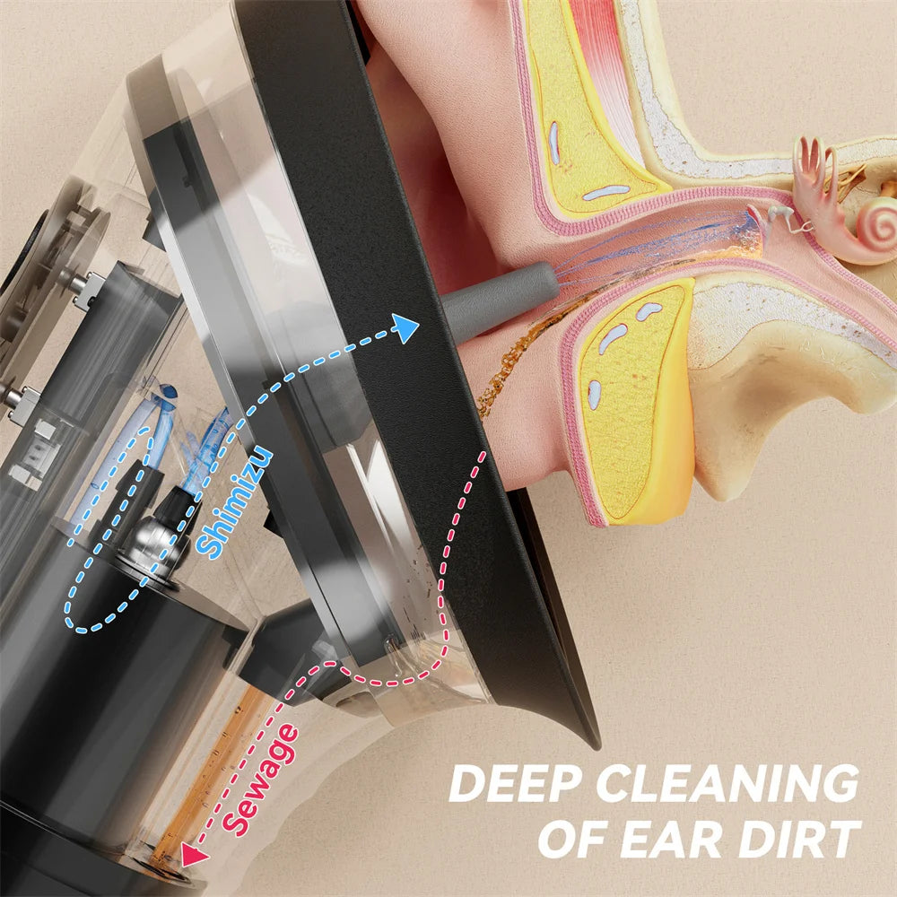 Vortex™— 360°Ear Hygiene System